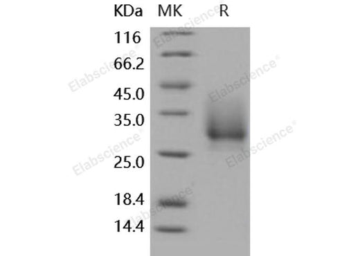 Recombinant Human CD147/Basigin Protein (His Tag) - ABMIUM