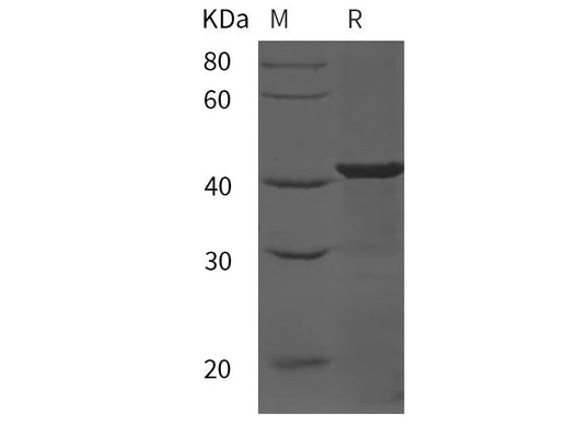 SDS-PAGE analysis of Mouse Prostatic Acid Phosphatase/ACPP proteins, 2 μg/lane of Recombinant Mouse Prostatic Acid Phosphatase/ACPP proteins was resolved with SDS-PAGE under reducing conditions, showing bands at 43 kDa.