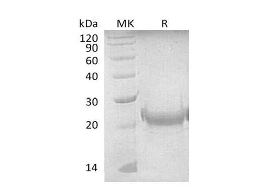 Recombinant Mouse TNFSF4/OX40L Protein (His Tag) - ABMIUM