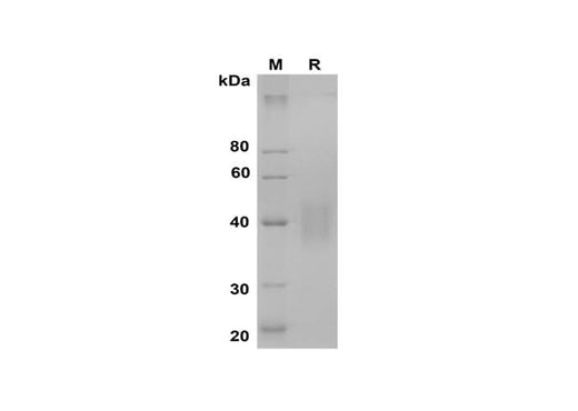 SDS-PAGE analysis of Mouse Factor D/Cfd proteins, 2 μg/lane of Recombinant Mouse Factor D/Cfd proteins was resolved with SDS-PAGE under reducing conditions, showing bands at 38-45 kDa.