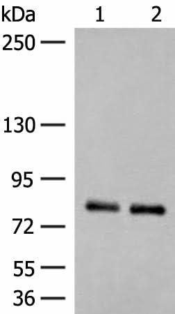 Western blot analysis of Rat brain tissue and Mouse brain tissue lysates using NGEF Polyclonal Antibody at dilution of 1:250