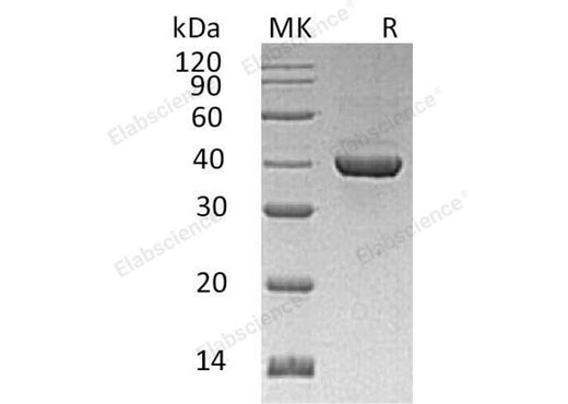 Recombinant Human ALDOC Protein (His Tag) - ABMIUM
