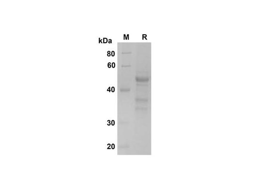 SDS-PAGE analysis of Human IL-23 proteins , 2 μg/lane of Recombinant Human IL-23 proteins was resolved with SDS-PAGE under reducing conditions , showing bands at 45 kDa.