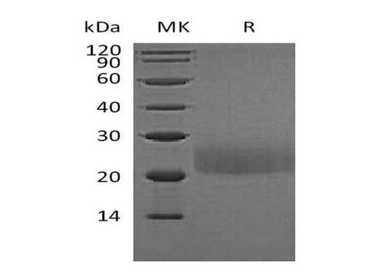 Recombinant Mouse CTLA4 Protein (Flag Tag) - ABMIUM