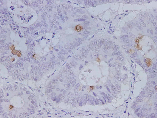 Anti-Human MUC5AC Antibody - ABMIUM