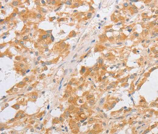 Anti-Human CDKN2AIP Antibody