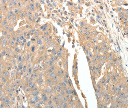Anti-Human SFTPD Antibody - ABMIUM