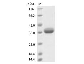 Recombinant SARS-CoV-2 Spike RBD(Q414R)(His Tag) - ABMIUM