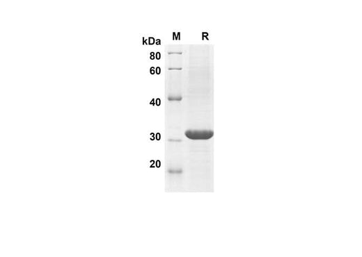 SDS-PAGE analysis of Mouse CCL11 proteins, 2 μg/lane of Recombinant Mouse CCL11 proteins was resolved with SDS-PAGE under reducing conditions, showing bands at 28.1 kDa.