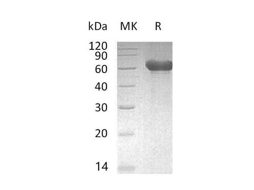 Recombinant Mouse CD300a/LMIR1 Protein (Fc Tag) - ABMIUM