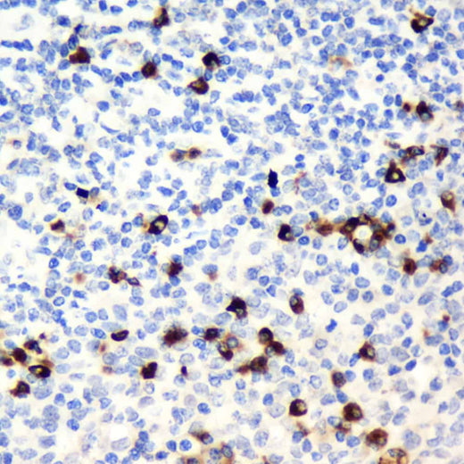 Immunohistochemistry analysis of paraffin-embedded Human tonsil using CD19 Polyclonal Antibody at dilution of 1:300.