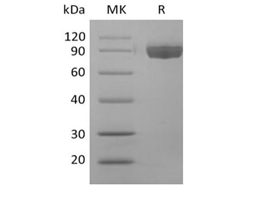 Recombinant Human Afamin/AFM (C-6His) - ABMIUM