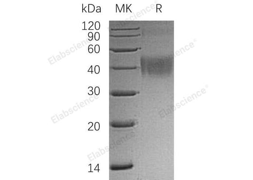 Recombinant Human OX-2/MOX1/CD200 Protein (His Tag) - ABMIUM