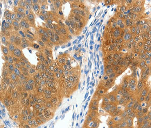 Anti-Human SCN9A Antibody - ABMIUM