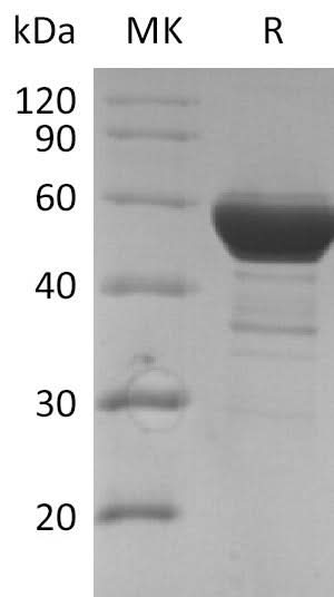 Recombinant SARS-CoV Nucleocapsid Protein - ABMIUM