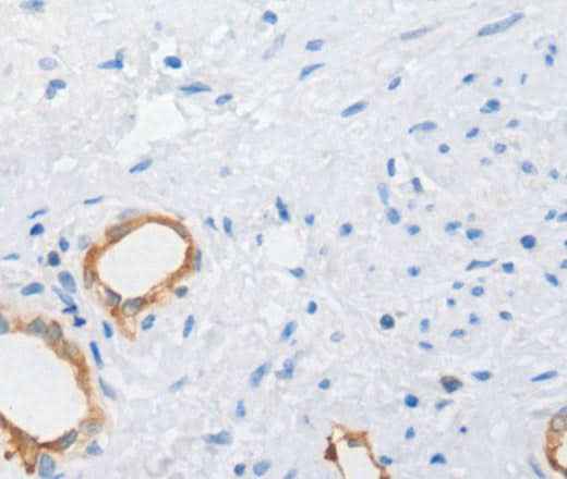 Anti-Human MUC5AC Antibody