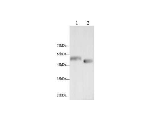 Anti-Mouse/Rat PDK4 Antibody - ABMIUM