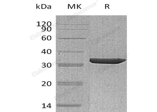 Recombinant Human Annexin A3/ANXA3 Protein - ABMIUM