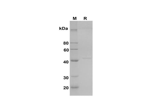 SDS-PAGE analysis of Rat AST proteins, 2 μg/lane of Recombinant Rat AST proteins was resolved with SDS-PAGE under reducing conditions, showing bands at 44 kDa.