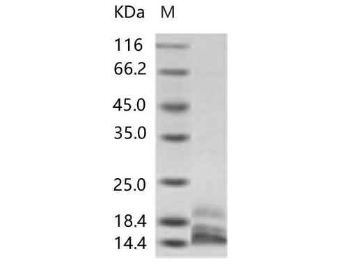 Recombinant DENV (type 2, strain New Guinea C/PUO-218 hybrid) E / Envelope Protein (Domain III, His Tag) - ABMIUM
