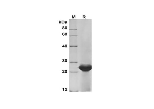 SDS-PAGE analysis of Human IFNAR1 proteins, 2 μg/lane of Recombinant Human IFNAR1 proteins was resolved with SDS-PAGE under reducing conditions, showing bands at 24 kDa.