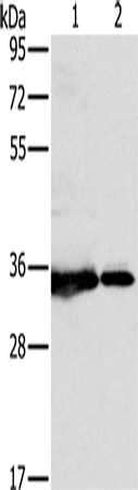 Anti-Human/Mouse NDUFAF1 Antibody - ABMIUM