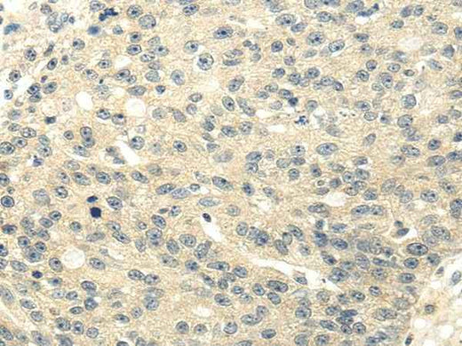 Anti-Human/Mouse/Rat GAD1 Antibody