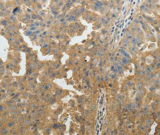 Anti-Human/Mouse/Rat SYT6 Antibody