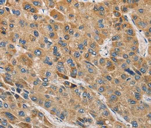 Anti-Human MIP Antibody