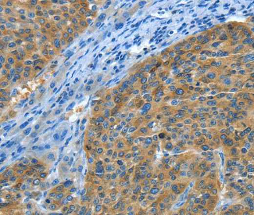 Anti-Human Amphiphysin II Antibody