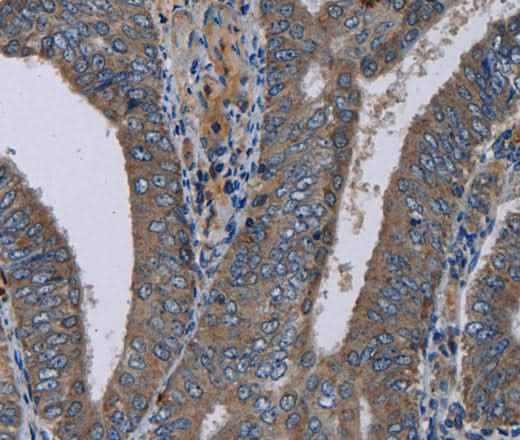 Anti-Human/Mouse NECTIN4 Antibody