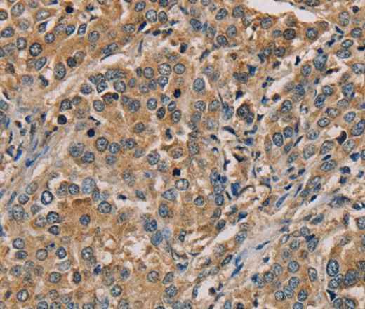 Anti-Human NANOS2 Antibody