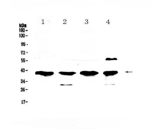 Anti-VEGFD/FIGF Antibody Picoband® Boster Bio