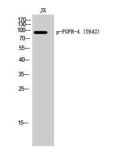 Western Blot analysis of Jurkat cells with Phospho-FGFR4 (Tyr642) Polyclonal Antibody