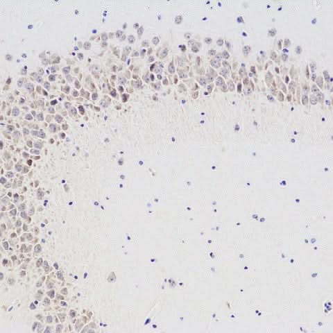 Immunohistochemistry analysis of paraffin-embedded mouse brain using CHAT Polyclonal Antibody at dilution of 1:300.