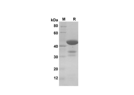 SDS-PAGE analysis of Human PFN1 proteins, 2 μg/lane of Recombinant Human PFN1 proteins was resolved with SDS-PAGE under reducing conditions, showing bands at 42 kDa.