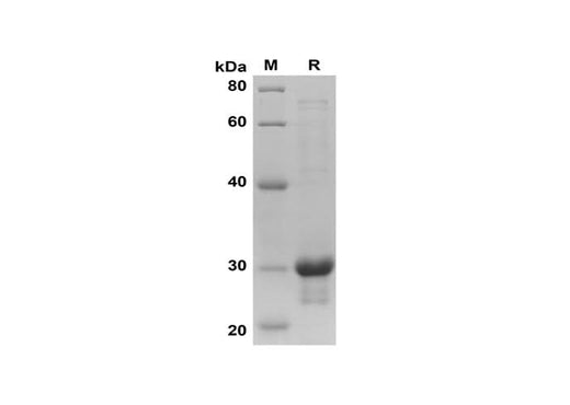 SDS-PAGE analysis of Human CXCL12 proteins, 2 μg/lane of Recombinant Human CXCL12 proteins was resolved with SDS-PAGE under reducing conditions, showing bands at 30 kDa.