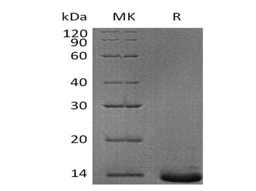 Recombinant Human Pro-Neuropeptide Y/NPY Protein (His Tag) - ABMIUM