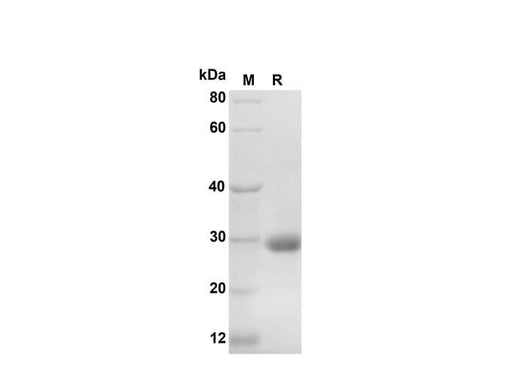 SDS-PAGE analysis of Human CXCL4/CXCL4/PF4 proteins, 2 μg/lane of Recombinant Human CXCL4/CXCL4/PF4 proteins was resolved with SDS-PAGE under reducing conditions, showing bands at 30 kDa.