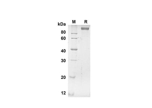 SDS-PAGE analysis of Human ANPEP proteins, 2 μg/lane of Recombinant Human ANPEP proteins was resolved with SDS-PAGE under reducing conditions, showing bands at 98.8 kDa.