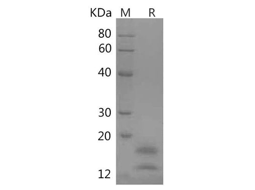 SDS-PAGE analysis of Human VEGF121 proteins, 2 μg/lane of Recombinant Human VEGF121 proteins was resolved with SDS-PAGE under reducing conditions, showing bands at 14 kDa;18 kDa.