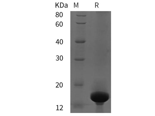 SDS-PAGE analysis of Rat Chymase proteins, 2 μg/lane of Recombinant Rat Chymase proteins was resolved with SDS-PAGE under reducing conditions, showing bands at 15 kDa.