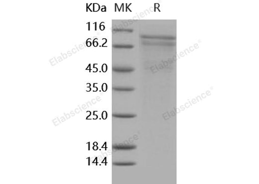 Recombinant Human R-Cadherin/CDH4 Protein (His Tag) - ABMIUM