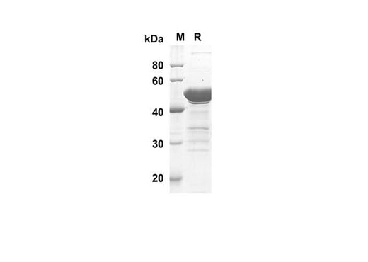 SDS-PAGE analysis of Human CDH1 proteins, 2 μg/lane of Recombinant Human CDH1 proteins was resolved with SDS-PAGE under reducing conditions, showing bands at 47.3 kDa.