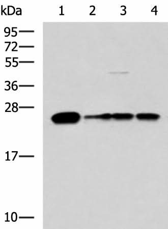 Western blot analysis of 293T LO2 and HepG2 cell lysates using MMAB Polyclonal Antibody at dilution of 1:1400