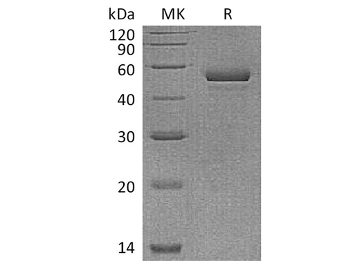 Recombinant Human NPTX1 Protein (His Tag) - ABMIUM
