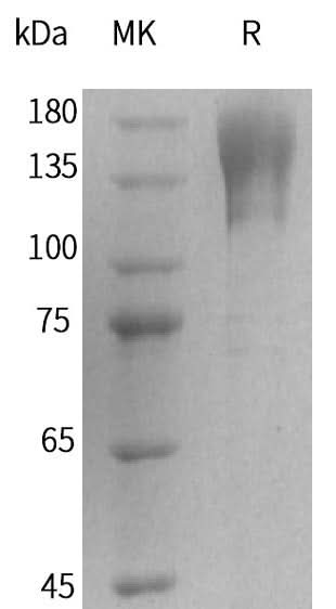 Recombinant Human T-cell Surface Protein Tactile/CD96(C-Fc) - ABMIUM