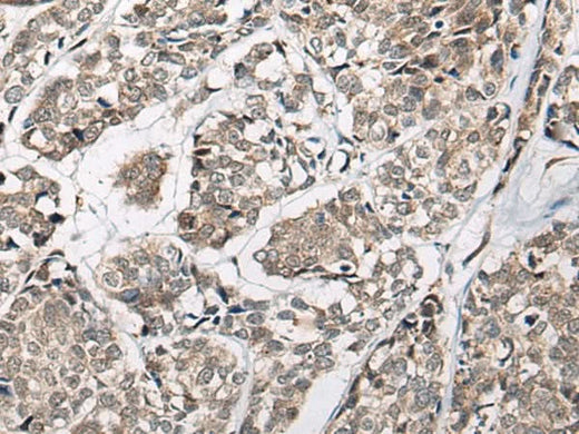 Anti-Human/Mouse/Rat CACNB3 Antibody - ABMIUM