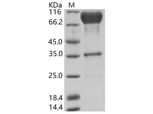 Recombinant EBOV (subtype Zaire, strain Mayinga 1976) Glycoprotein / GP-RBD Protein (Fc Tag) - ABMIUM