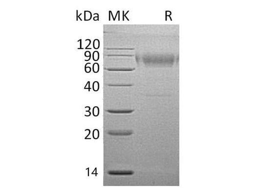 Recombinant Mouse IL18BP Protein (Fc Tag) - ABMIUM